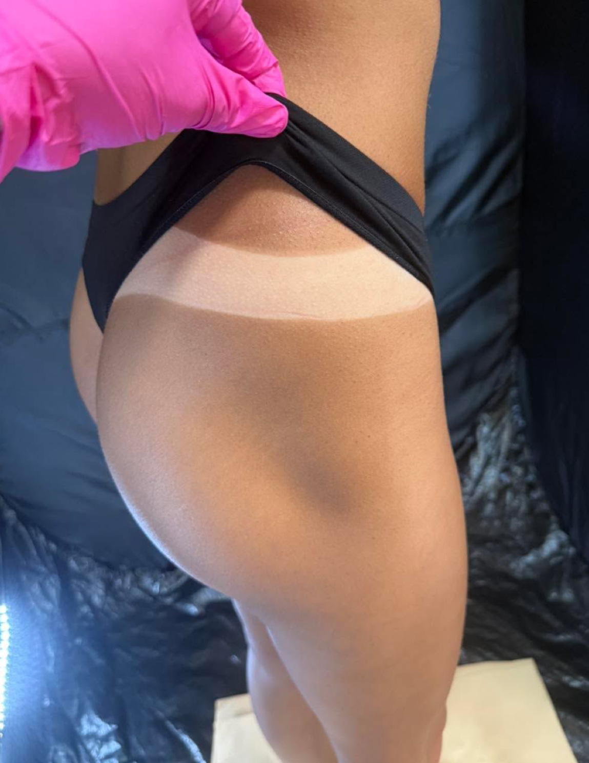 Close-up of a person's thigh with a bandage or tape applied, and a gloved hand adjusting clothing.