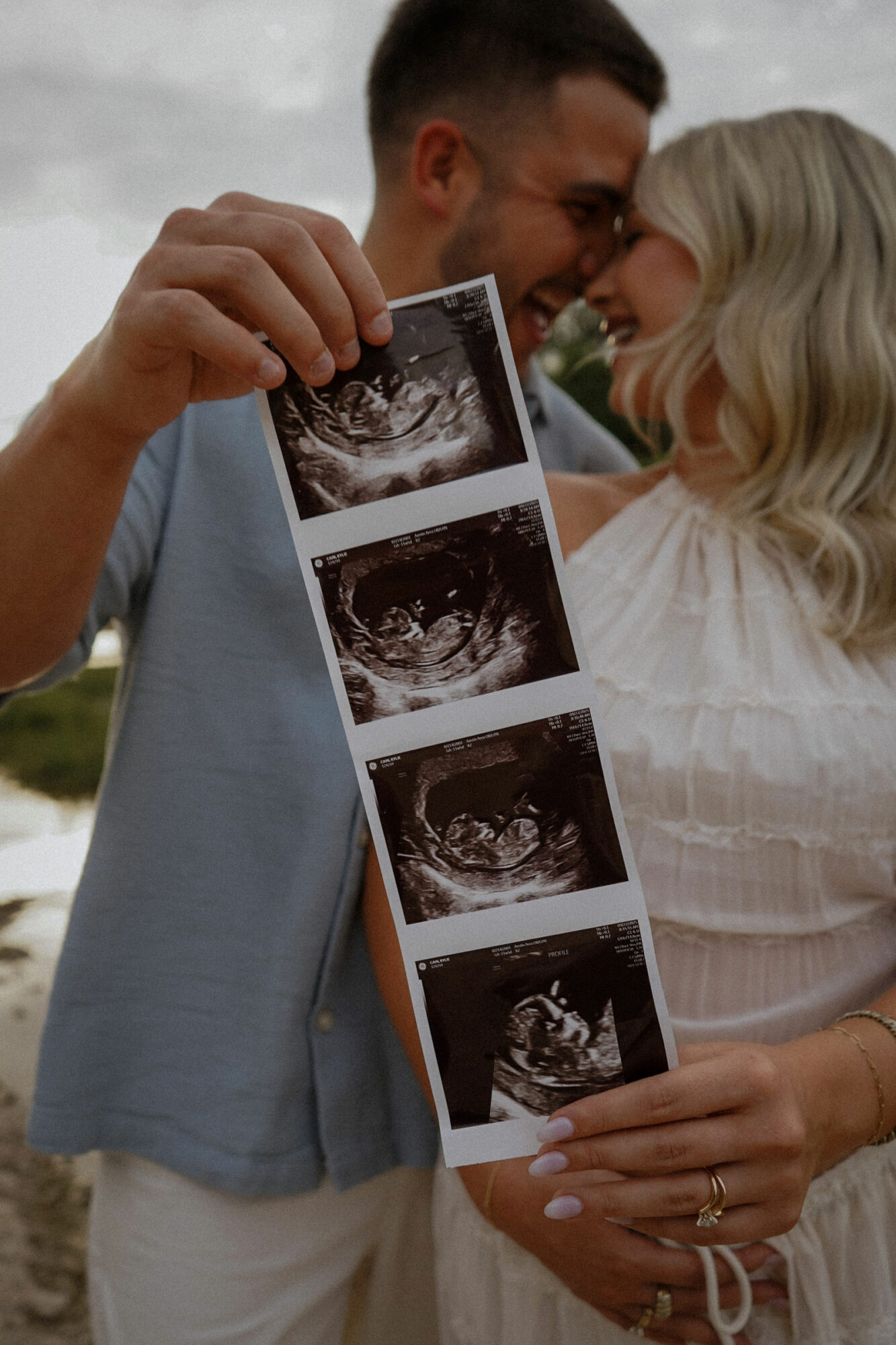 Couple holding ultrasound images, smiling and touching foreheads outdoors, celebrating pregnancy.