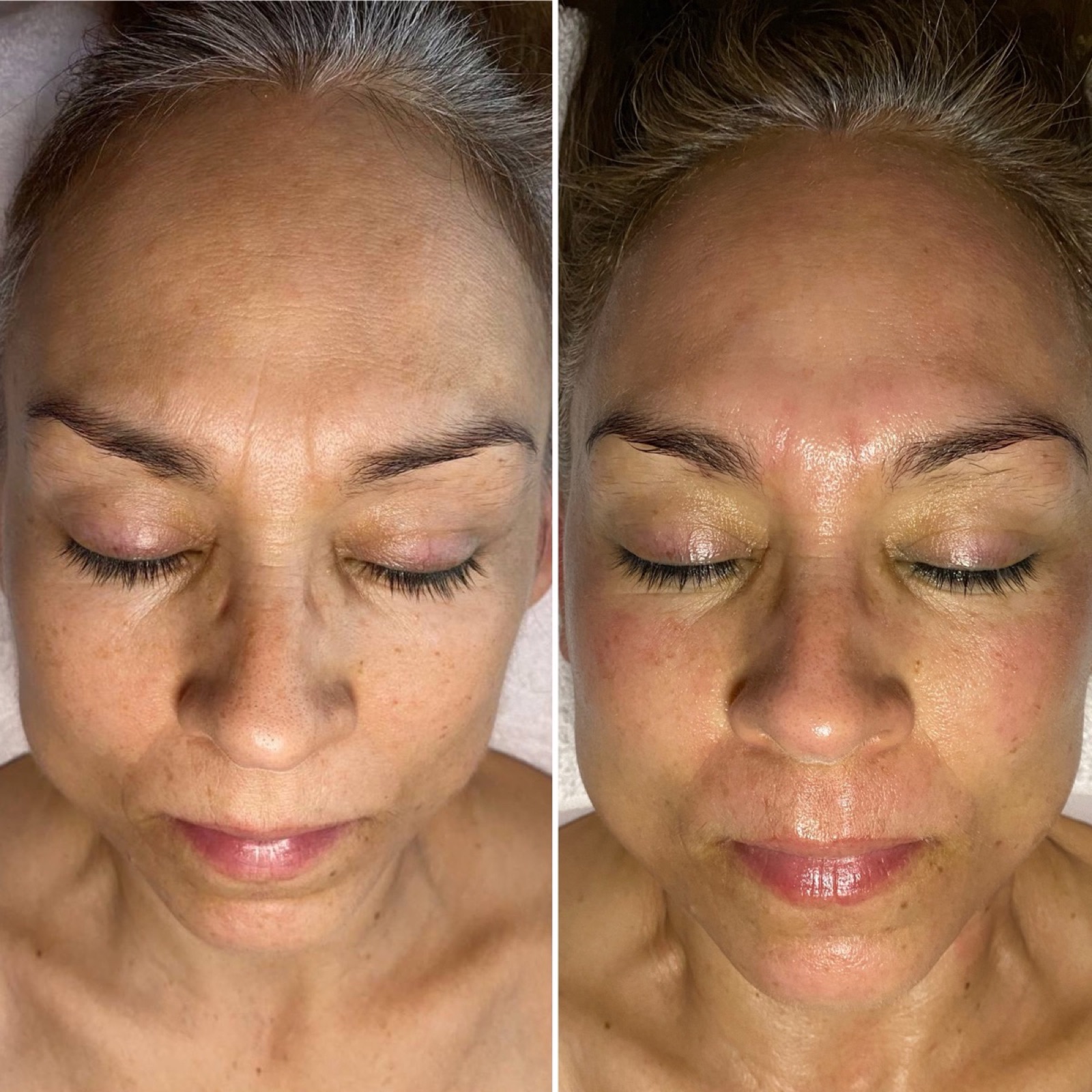 Side-by-side comparison of a woman's face before and after skincare, with closed eyes and relaxed expression.