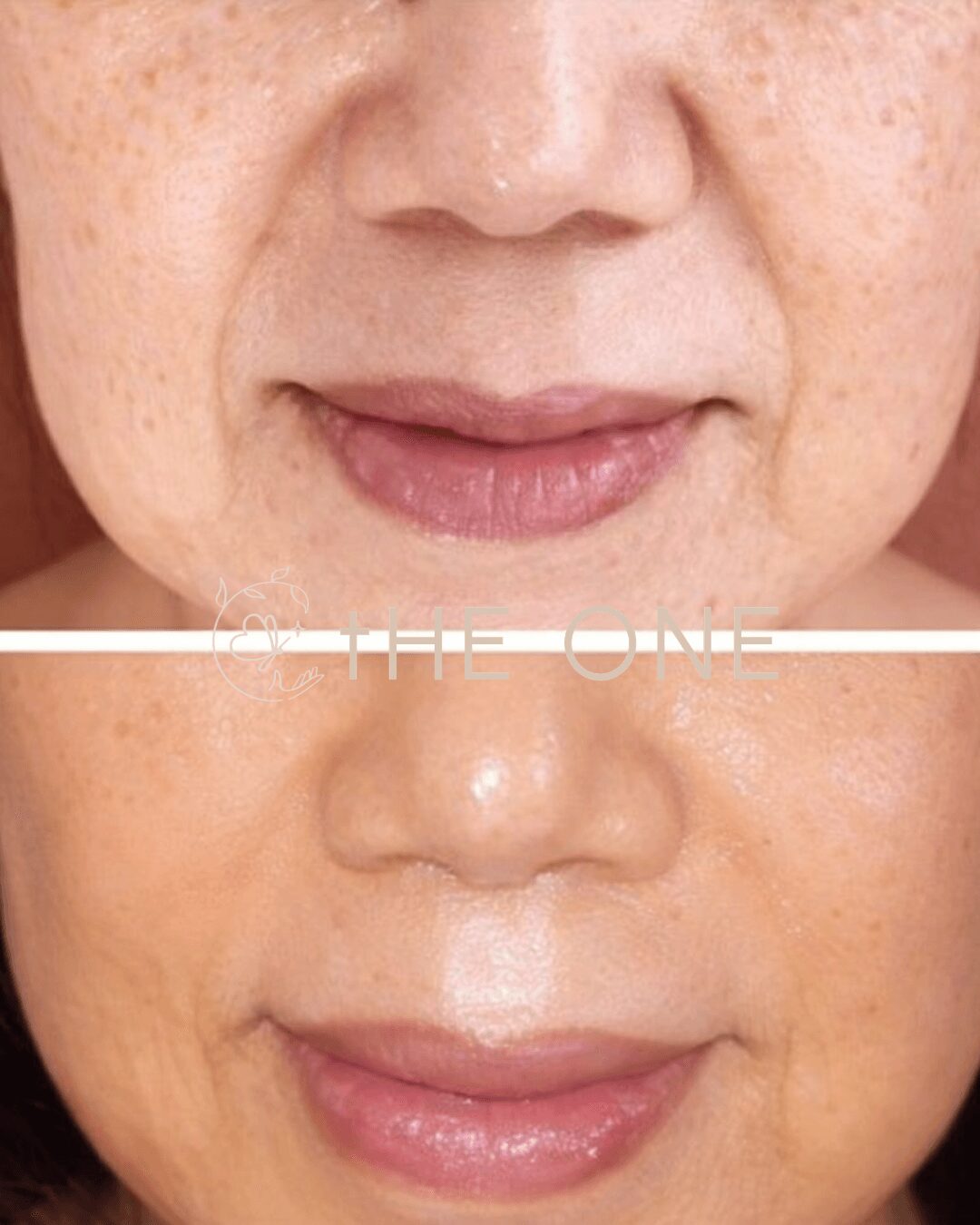 Close-up of a person's face showing skin texture and lips, with a white line and text across the middle.