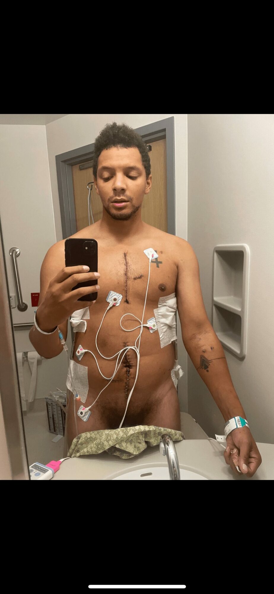 Man taking a mirror selfie in a hospital room, shirtless with medical wires attached, holding a phone in his right hand.