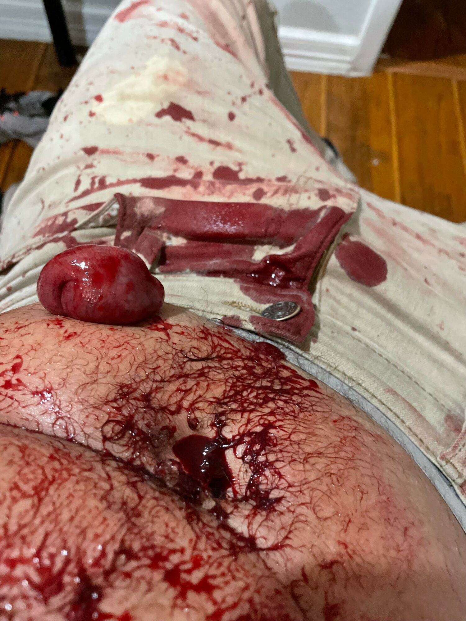 Person wearing bloodstained clothing with a bloodied apple and medical tools on their abdomen, viewed from above.
